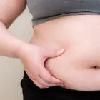 産後の肥満